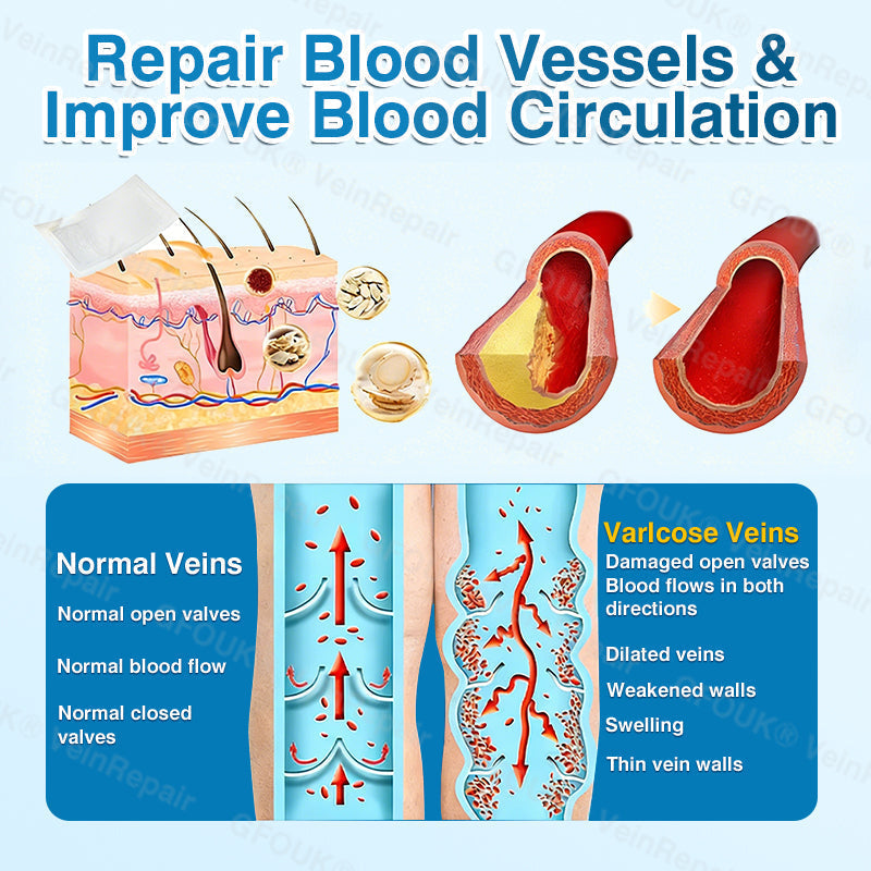 🇦🇺🏆✅️🏃GFOUK® VeinRepair Microneedle Patch Roll⚡Instant Relief, Long-Term Results