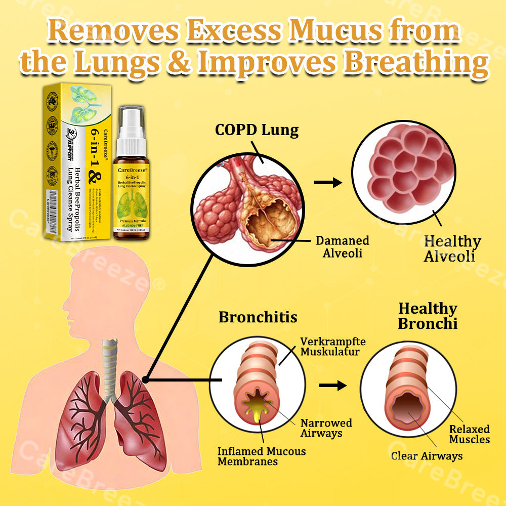 🫁✅🐝🇦🇺 Official Store:Healrize® 6-in-1 Herbal BeePropolis Lung Cleanse Spray（👨‍⚕️Directly acts on COPD, asthma, chronic bronchitis (CB), respiratory infections, lung cancer, sinusitis, and other conditions🫁)