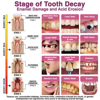 🇺🇸Rolimey® DenPerm Cavity-Repair Natural Enamel Filling Gel